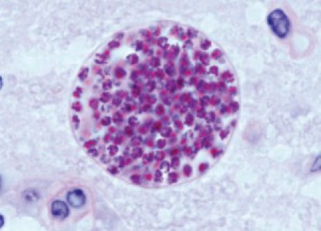 Toxoplasma cysta