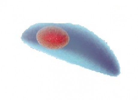 toxoplazma model